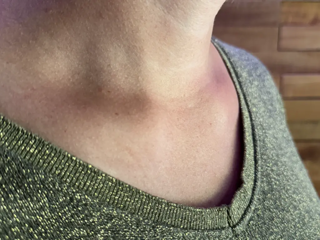 IMG_8572 (Custom).webp